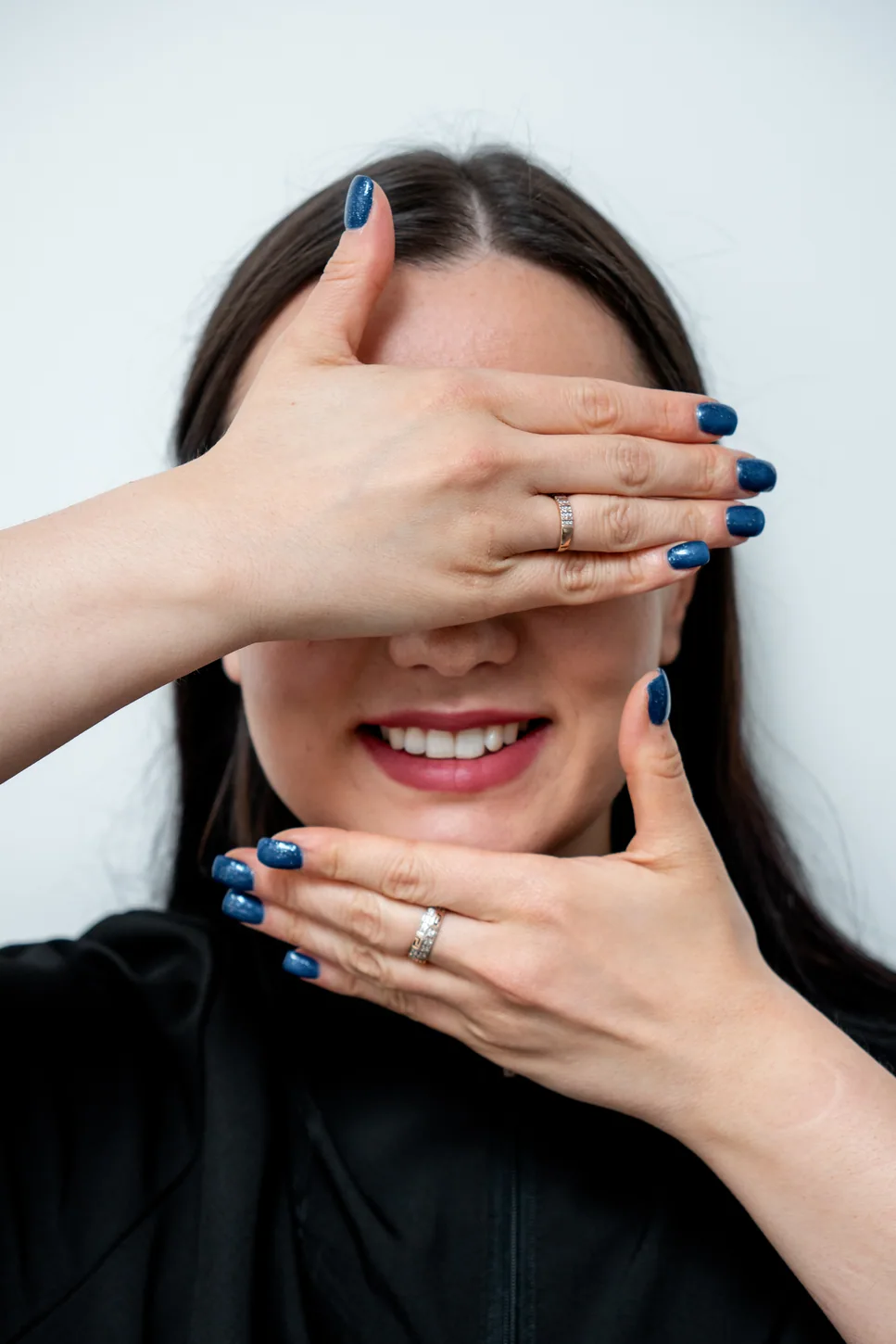 Консультация в клинике Open Smile