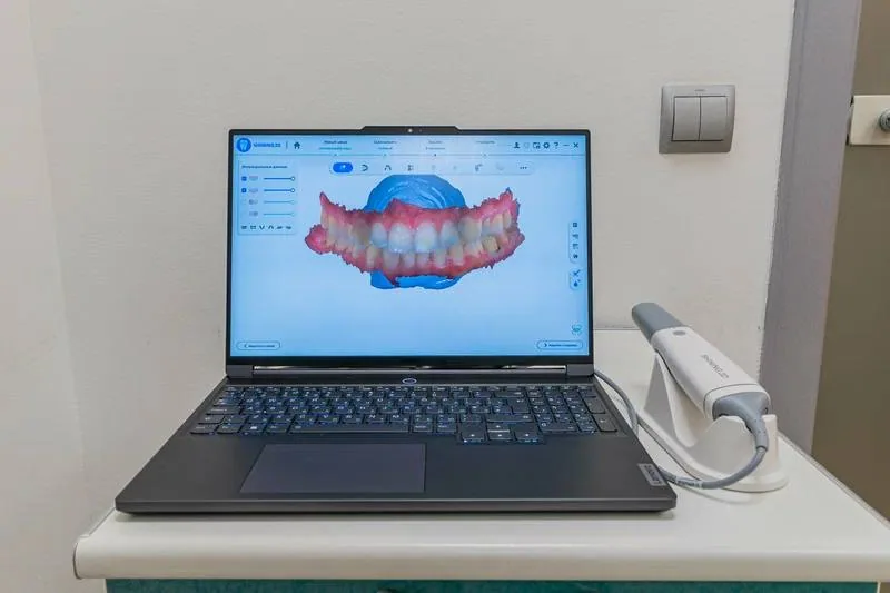 Экран цифровой диагностики Open Smile
